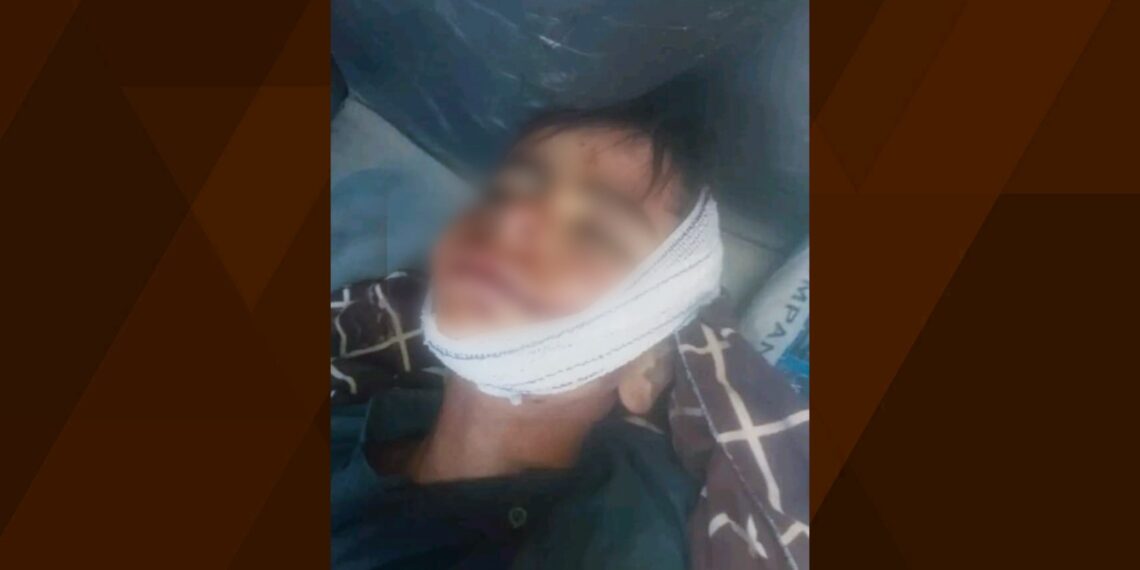 بدخشان کې له خلکو سره په کوکنارو د طالبانو جګړه کې یو ماشوم و وژل شو