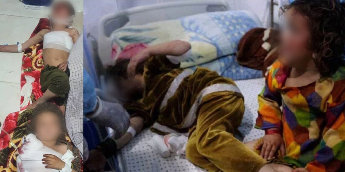 یوناما: پر افغانستان د پاکستان په بریدونو کې ۲۸ تنه وژل شوي او ۴۹ ټپیان دي
